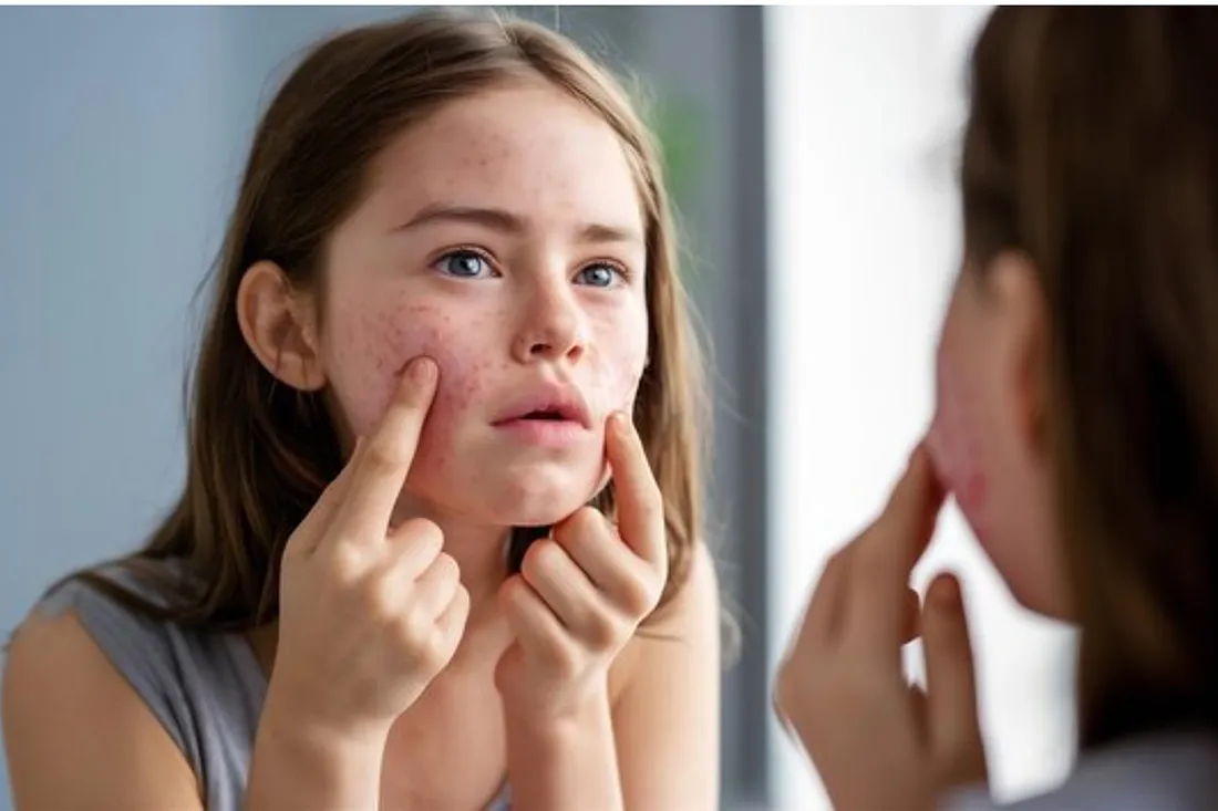 Rekomendasi Skincare Anak Usia 12 Tahun